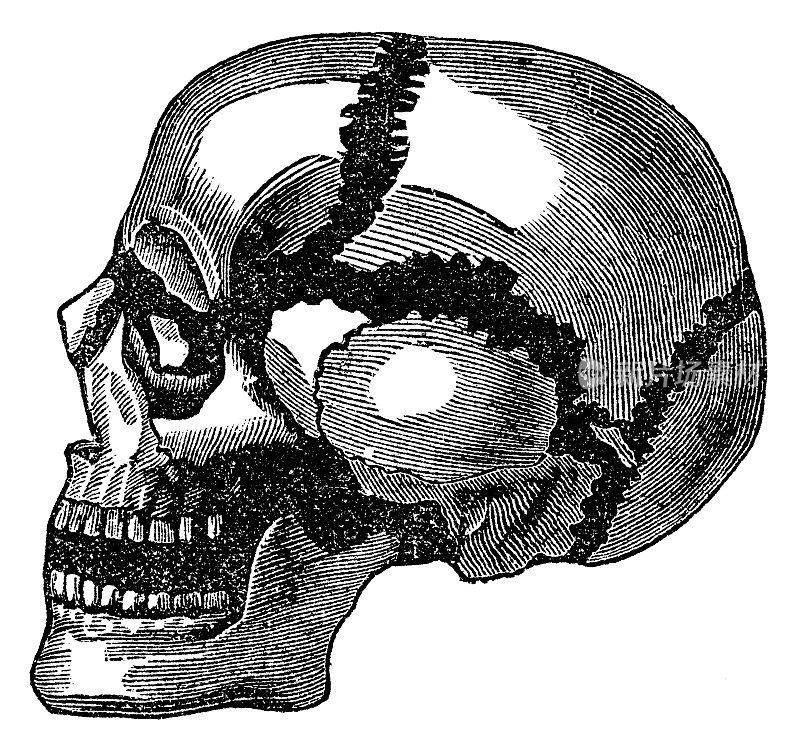 医学插图的人类头骨与骨头分离- 19世纪